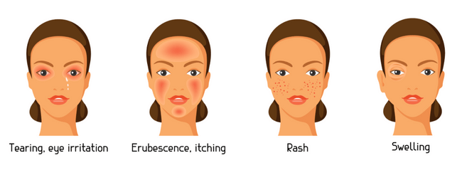 Allergy symptoms